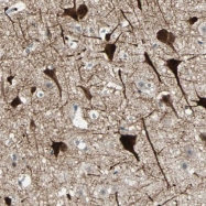 NBP1-81346 - ZNF36