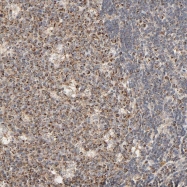 NBP1-85794 - ZMAT5