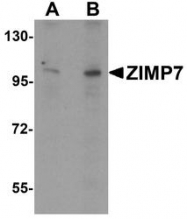 NBP1-76552 - ZMIZ2
