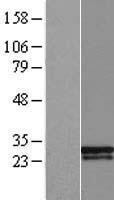 NBL1-18047 - ZMYM5 Lysate