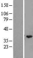 NBL1-18050 - ZMYND12 Lysate