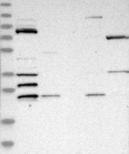 NBP1-84179 - ZMYND15