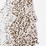 NBP1-87277 - ZNF134