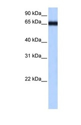 NBP1-56337 - ZNF14