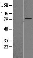 NBL1-18065 - ZNF16 Lysate