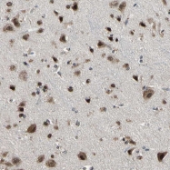 NBP1-86821 - ZNF174