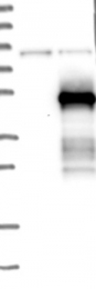 NBP1-86821 - ZNF174