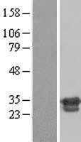 NBL1-18069 - ZNF174 Lysate