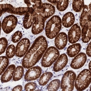 NBP1-92618 - ZNF181