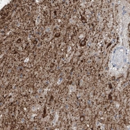 NBP1-85915 - ZNF189