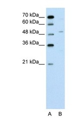 NBP1-53031 - ZNF19