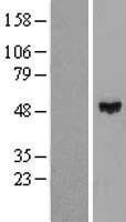 NBL1-18078 - ZNF193 Lysate