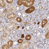 NBP1-80604 - ZNF205