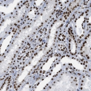 NBP1-89550 - ZNF207
