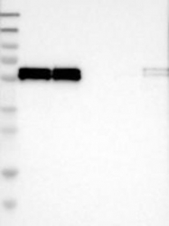 NBP1-89550 - ZNF207