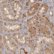 NBP1-81631 - ZNF226