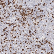NBP1-85930 - ZNF227