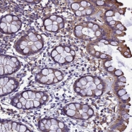 NBP1-92619 - ZNF235