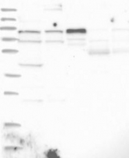 NBP1-81868 - ZNF263