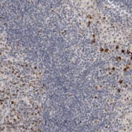 NBP1-82529 - ZNF277