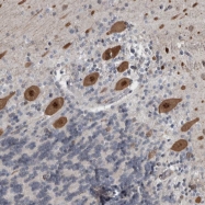 NBP1-82923 - ZNF295