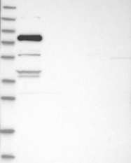 NBP1-82923 - ZNF295