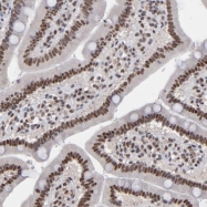 NBP1-89329 - ZNF3