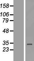 NBL1-18113 - ZNF302 Lysate