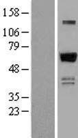 NBL1-18038 - ZNF307 Lysate