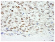 NB100-77289 - ZNF318