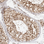 NBP1-83208 - ZNF318