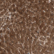 NBP1-80594 - ZNF323