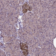 NBP1-92622 - ZNF329
