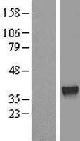 NBL1-18119 - ZNF330 Lysate