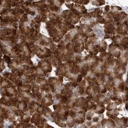 NBP1-84219 - ZNF341