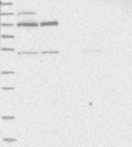 NBP1-84219 - ZNF341