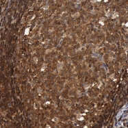 NBP1-80608 - ZNF350