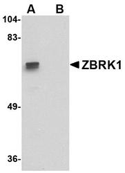 NBP1-76344 - ZNF350