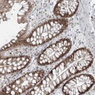 NBP1-82064 - ZNF354B