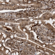 NBP1-83861 - ZNF358