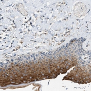 NBP1-81976 - ZNF367