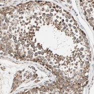 NBP1-81345 - ZNF37A