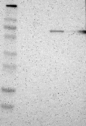 NBP1-81345 - ZNF37A
