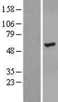 NBL1-18136 - ZNF385B Lysate