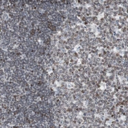 NBP1-82025 - ZNF396