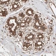 NBP1-82753 - ZNF397