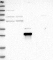 NBP1-82753 - ZNF397