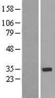 NBL1-18141 - ZNF397 Lysate