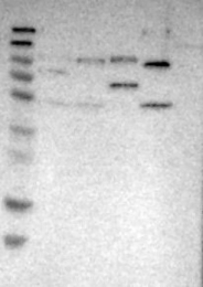 NBP1-82280 - ZNF408