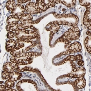 NBP1-80592 - ZNF419